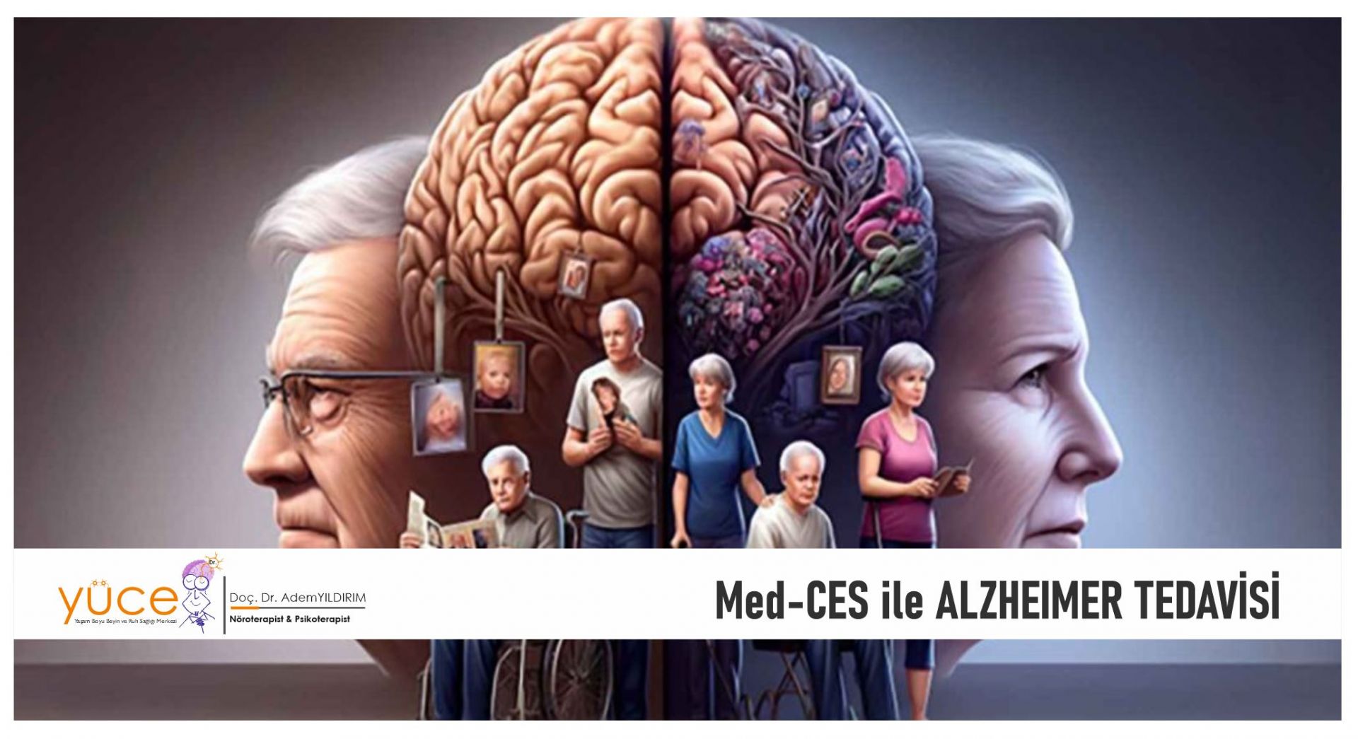 Alzheimer Nedir? Alzheimer Tedavisi?